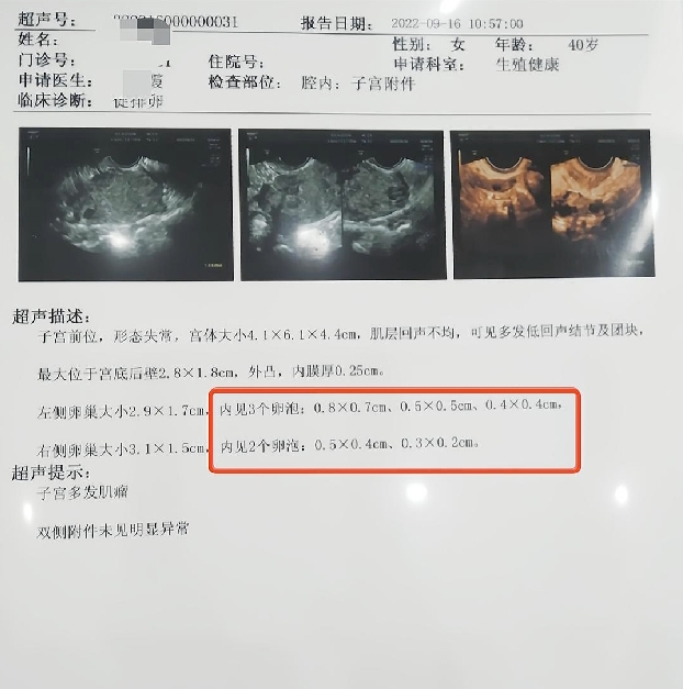 干细胞卵巢修复