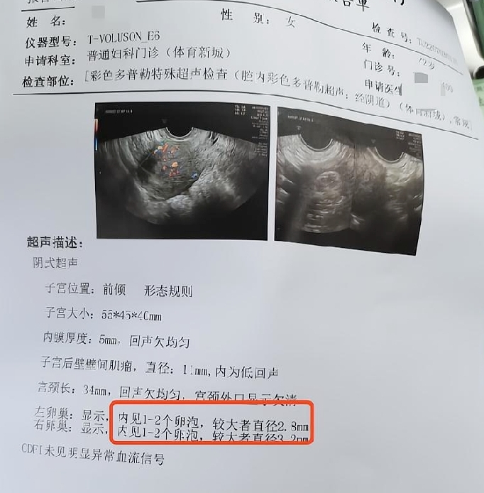 卵巢功能重建效